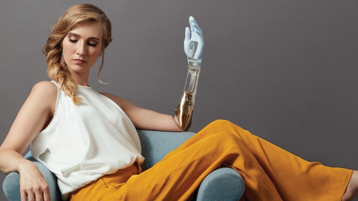 person with prosthetic arm